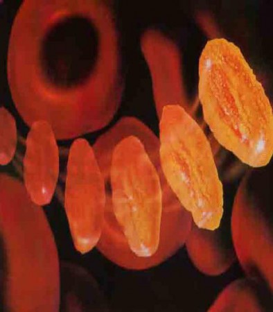 Aula Infuso de sangue e Deri